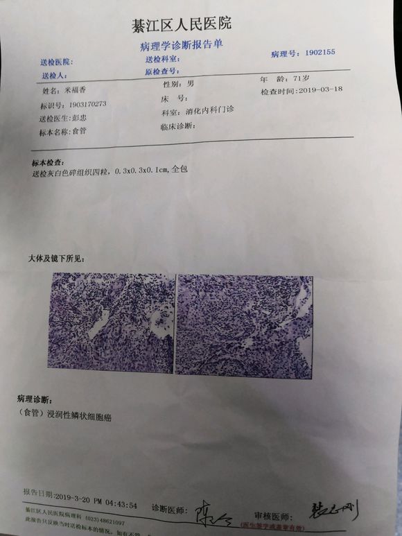 我爷爷，71岁，上周查出来食道癌中晚期