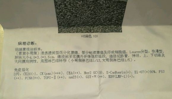 胃癌治疗求助