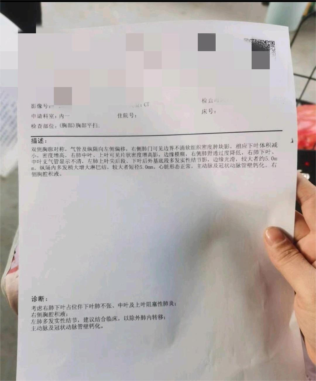 这是晚期嘛？